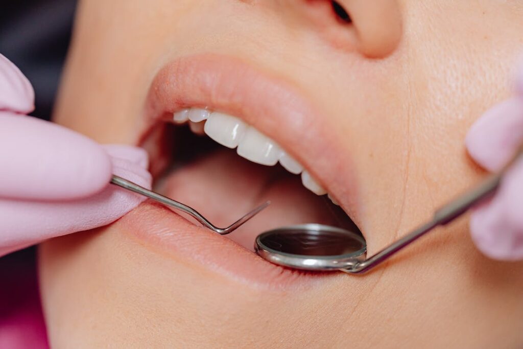 Cavities