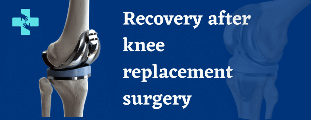 How Long After Knee Replacement Can You Drive